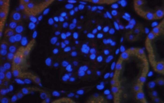 Innovative Rabbit Antibodies and Engineering for Therapeutics and Diagnostics