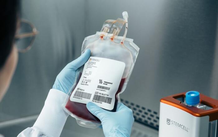 High-Quality Mobilized Leukopaks to Enhance Your Cell and Gene Therapy Research and Development