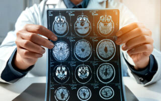 MRI Brain Scan. Doctor shows MRI Brain Scan of head and skull.