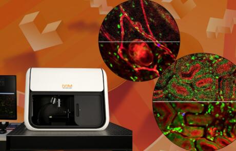 High-Resolution Intravital In Vivo Imaging with AI-Powered Image Denoising
