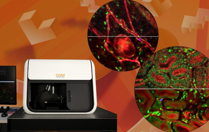 High-Resolution Intravital In Vivo Imaging with AI-Powered Image Denoising