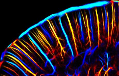 Iconeus One: Pioneering Real-Time Whole-Brain Imaging with Functional Ultrasound – 14 Years of Innovation and Adoption