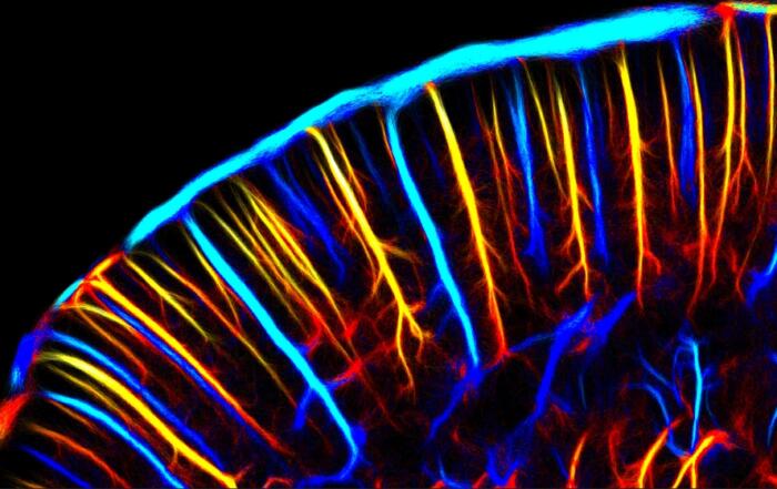 Iconeus One: Pioneering Real-Time Whole-Brain Imaging with Functional Ultrasound – 14 Years of Innovation and Adoption