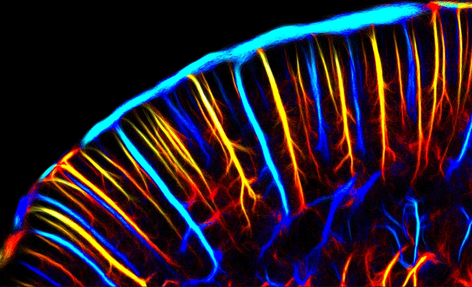 Iconeus One: Pioneering Real-Time Whole-Brain Imaging with Functional Ultrasound – 14 Years of Innovation and Adoption