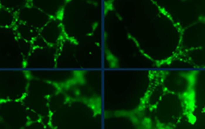 Modeling Angiogenesis in Real Time – A Qualitative, Real-time, In-vitro Tube Formation Assay