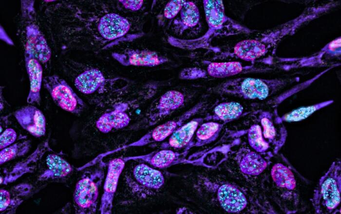 Biomarkers from Bench to Bedside: Tools, Targets, and Translational Insights