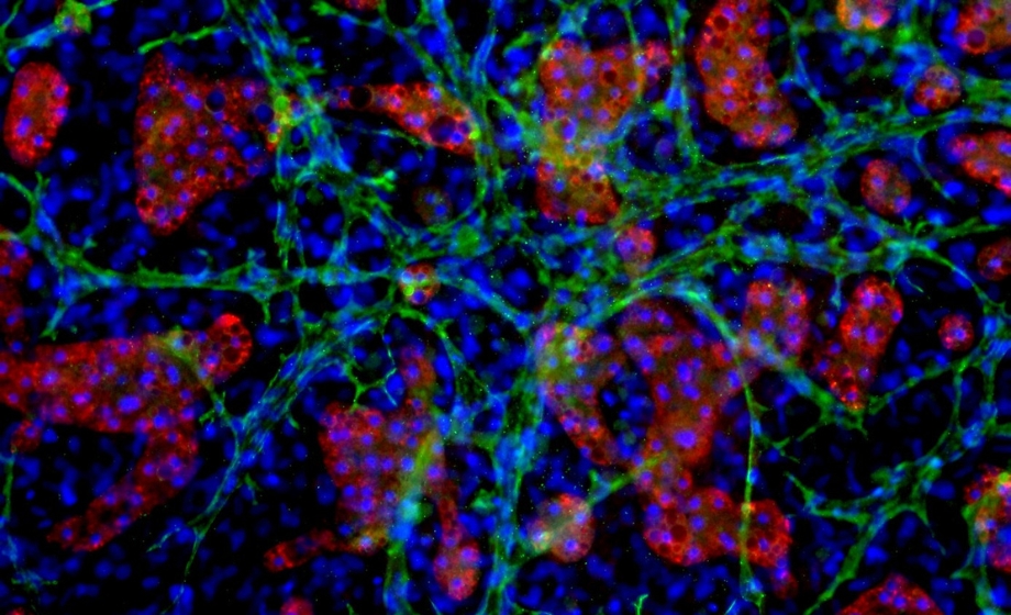 Improved Clearance Predictions for Aldehyde Oxidase Substrates Using TruVivo, a Novel Human Hepatocyte Model