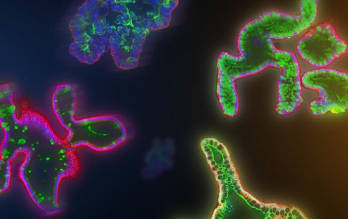The Hidden Variable in Your Intestinal Organoids: Enhancing Differentiation for a More Predictive Model