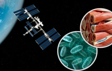Redox Regulation of Skeletal Muscle: A Journey from Liverpool to the International Space Station
