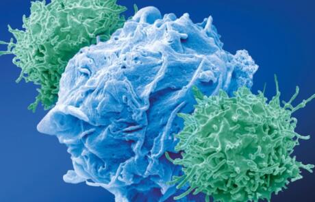 Advances in Preclinical Research using Human Co-culture Models: Applications in Immunology, Infectious Disease, and Oncology