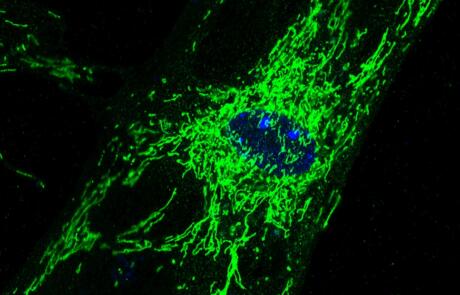 Reprogramming Mouse Fibroblasts Into Induced Cardiomyocytes: Age-Related, Metabolic, and Epigenetic Barriers
