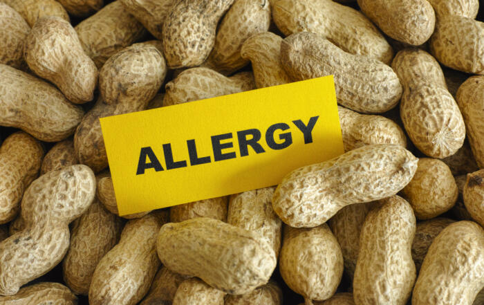 NIH Launches Study on Maternal Diet and Infant Food Allergy Prevention