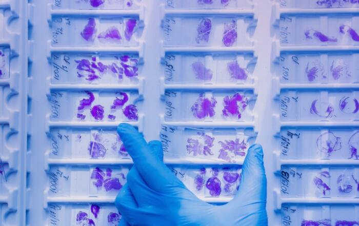 Human Biological Samples in Research: Quality, Compliance, and Clinical Relevance