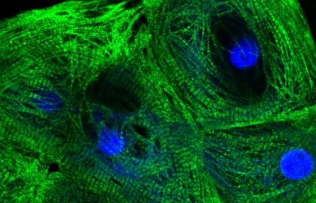 hiPSC-Cardiomyocyte Platforms Enabling Comprehensive Cardiac Toxicity and Drug Efficacy Evaluation