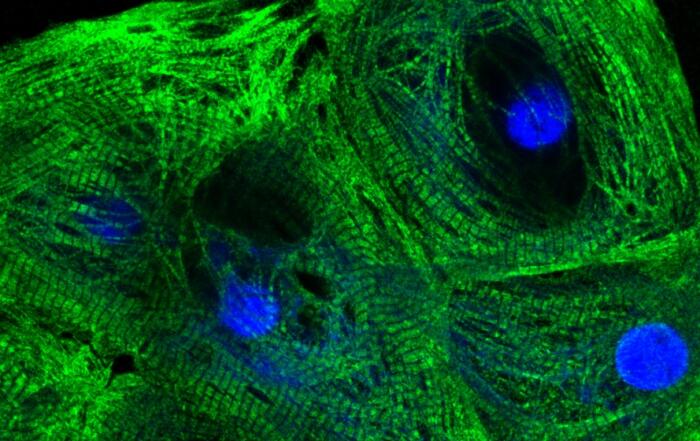 hiPSC-Cardiomyocyte Platforms Enabling Comprehensive Cardiac Toxicity and Drug Efficacy Evaluation