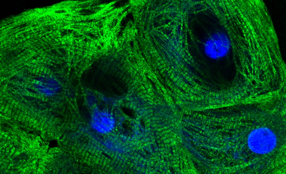 hiPSC-Cardiomyocyte Platforms Enabling Comprehensive Cardiac Toxicity and Drug Efficacy Evaluation