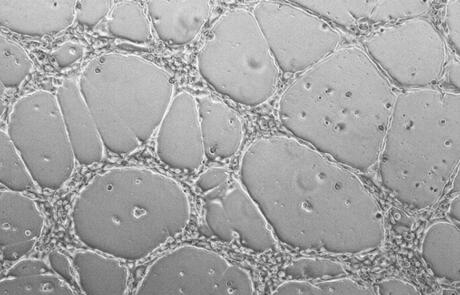 Building New Approach Methodologies for Angiogenesis and Vascularized Models