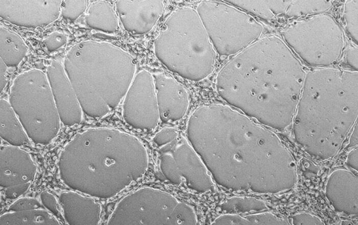 Building New Approach Methodologies for Angiogenesis and Vascularized Models