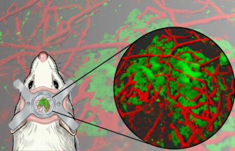 Opening a New Window: Stable Long-Term Imaging of Dura Mater–Transplanted Pancreatic Islets in Awake Mice