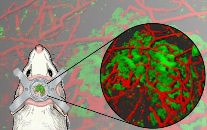 Opening a New Window: Stable Long-Term Imaging of Dura Mater–Transplanted Pancreatic Islets in Awake Mice