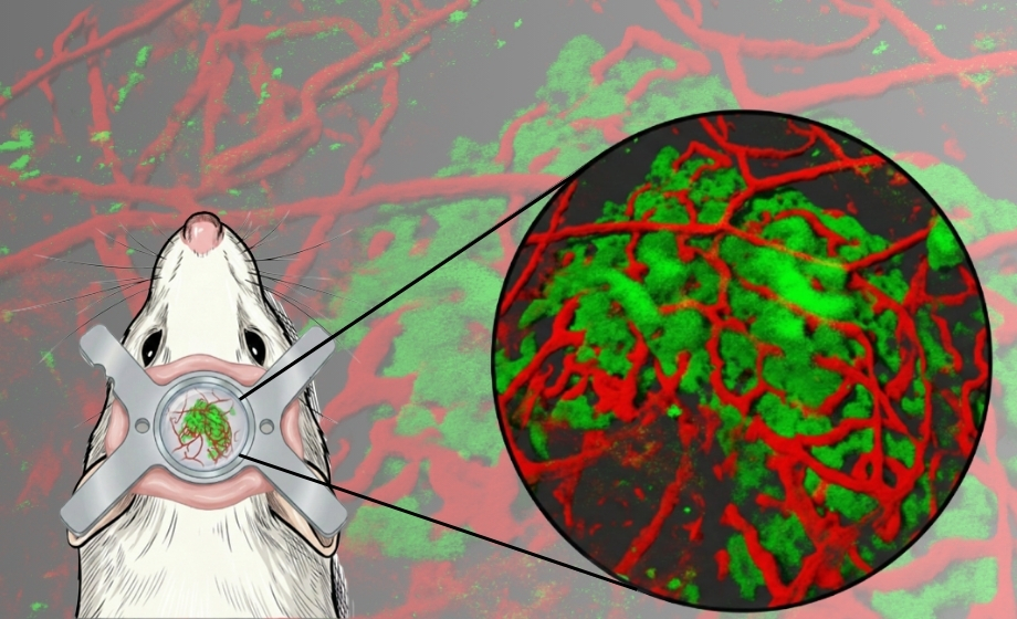 Opening a New Window: Stable Long-Term Imaging of Dura Mater–Transplanted Pancreatic Islets in Awake Mice