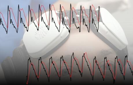Clinical Applications of Optical Cerebral Blood Flow Imaging