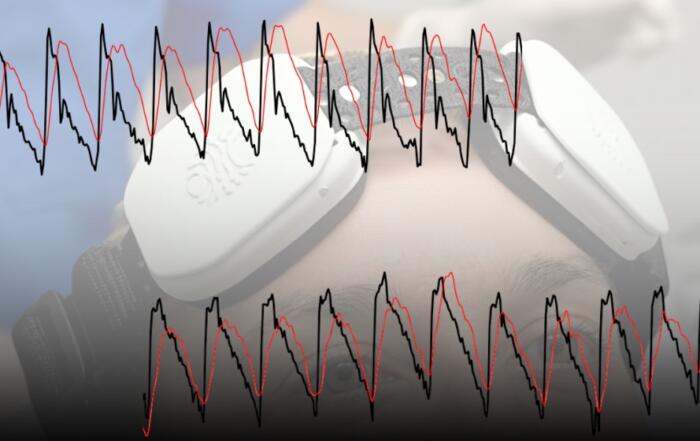 Clinical Applications of Optical Cerebral Blood Flow Imaging