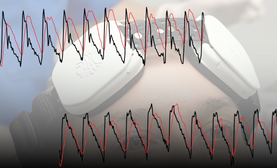 Clinical Applications of Optical Cerebral Blood Flow Imaging