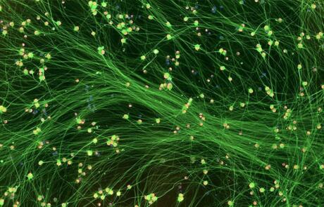 Human iPSC-Derived Sensory Neurons for Functional Sensory Biology and Pharmacology Research