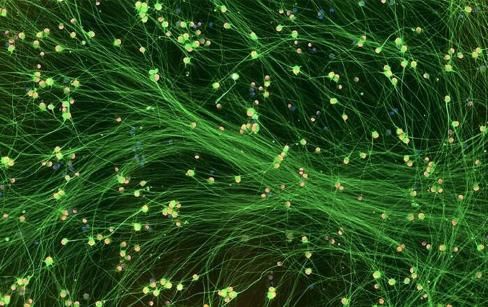 Human iPSC-Derived Sensory Neurons for Functional Sensory Biology and Pharmacology Research