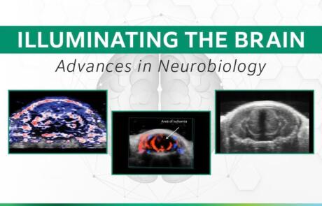 Illuminating the Brain: Advances in Neurobiology