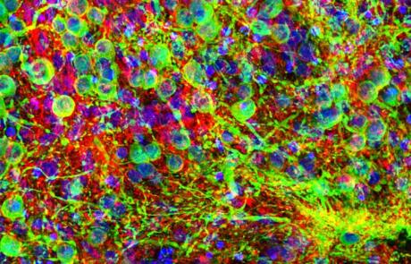 Detecting Early Synaptic Failure in Prion Disease Using Organoid Models