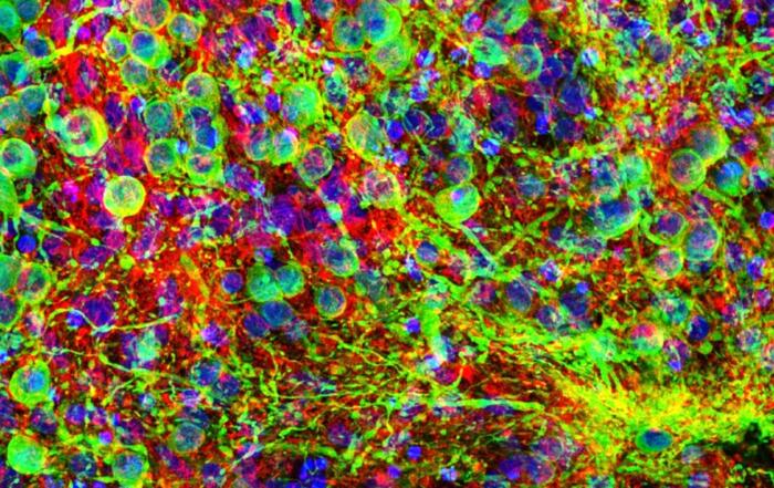 Detecting Early Synaptic Failure in Prion Disease Using Organoid Models