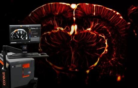 Functional Ultrasound Demonstration and Live Q&A: Iconeus One, a Pioneer in Real-Time Whole-Brain Imaging