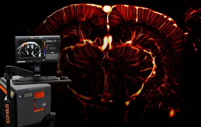 Functional Ultrasound Demonstration and Live Q&A: Iconeus One, a Pioneer in Real-Time Whole-Brain Imaging
