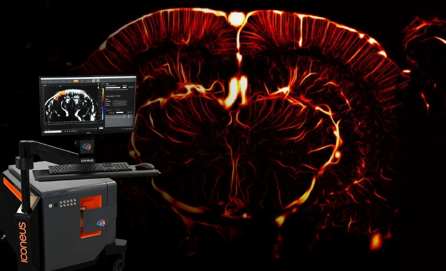 Functional Ultrasound Demonstration and Live Q&A: Iconeus One, a Pioneer in Real-Time Whole-Brain Imaging