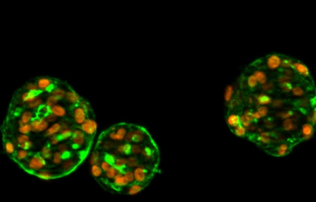Improving Confidence in Thyroid Hormone Disruption Assessment Using a Novel Human-Relevant In Vitro Model
