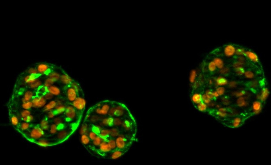 Improving Confidence in Thyroid Hormone Disruption Assessment Using a Novel Human-Relevant In Vitro Model