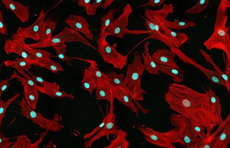 Advancing the Manufacture of Mesenchymal Stromal Cells and Derived Extracellular Vesicles in Stirred-Tank Bioreactors Through Enhanced Bioprocess Control