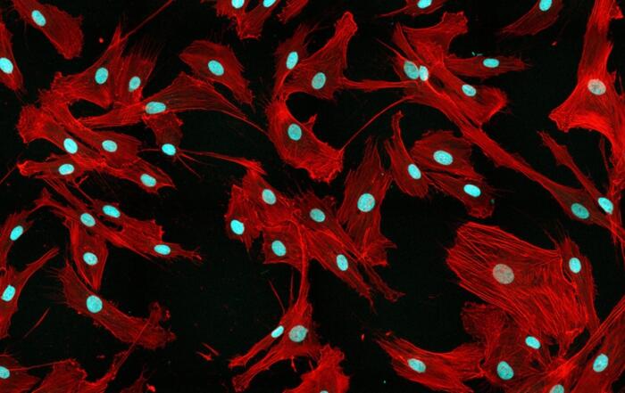 Advancing the Manufacture of Mesenchymal Stromal Cells and Derived Extracellular Vesicles in Stirred-Tank Bioreactors Through Enhanced Bioprocess Control